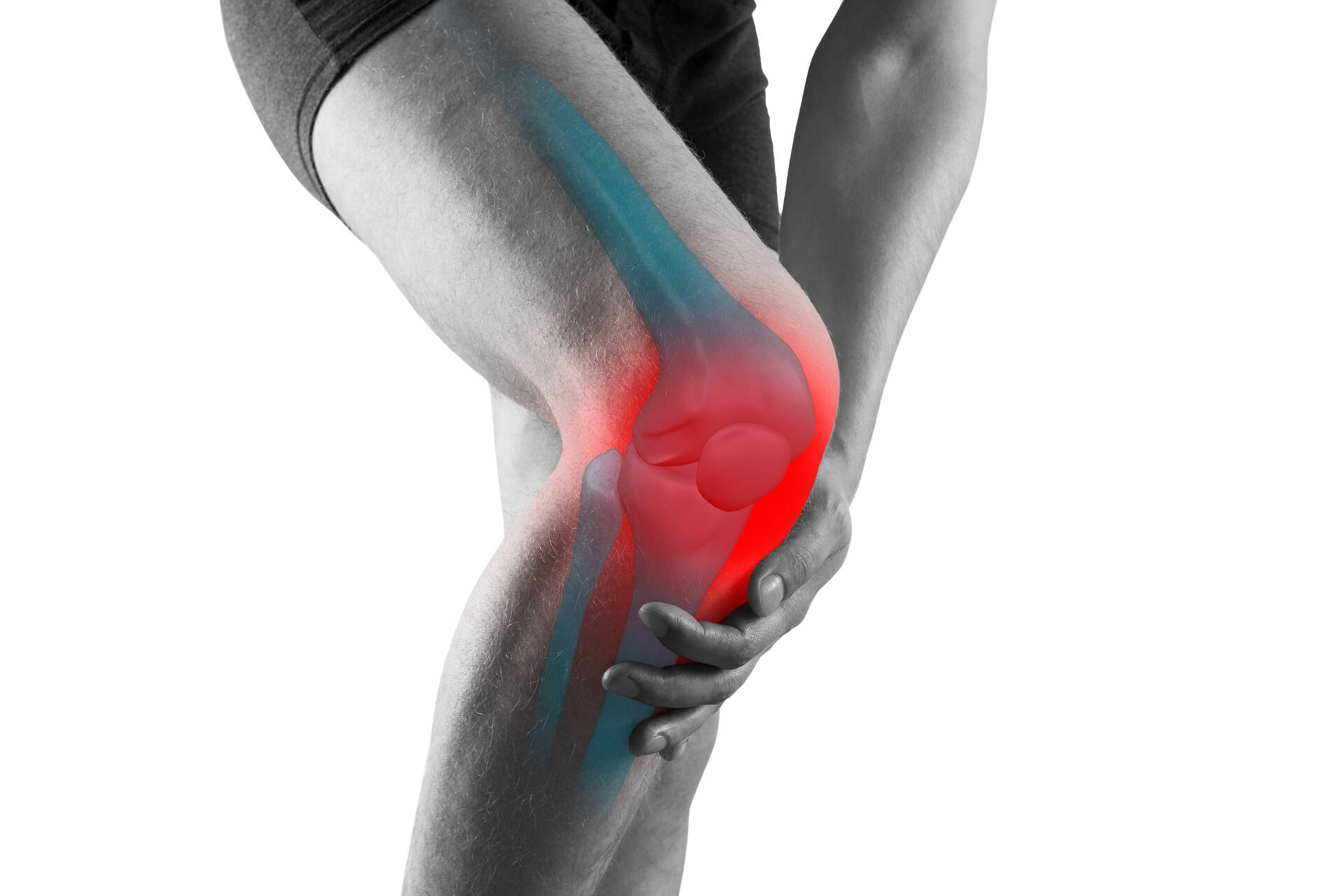Runnersknee | Heb je last van de buitenkant van je knie?